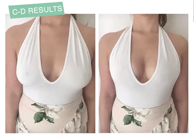 Lift Up Invisible Bra Tape - 1 Pair