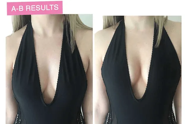 Lift Up Invisible Bra Tape - 1 Pair