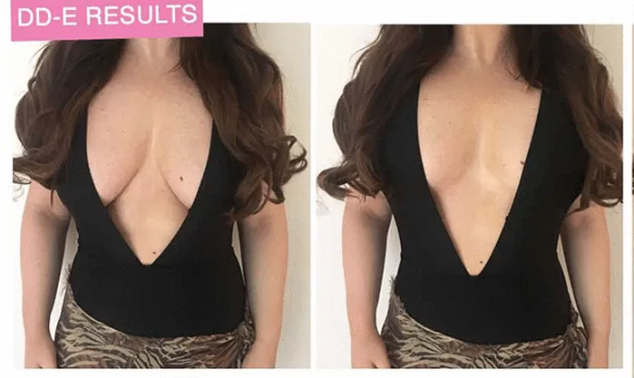 Lift Up Invisible Bra Tape - 1 Pair